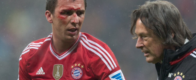 Marin MANDZUKIC (FC Bayern) with blood on his face is treated by FCB Dr. Hans-Wilhelm MUELLER-WOHLFAHRT -- photo: dpa